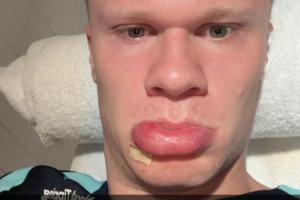 盛世美颜😂哈兰德早起撅香肠嘴晒自拍：早上好👍